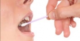 Suferi de boala parodontala? La Smileclinic poti face analiza microbiologica PET